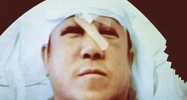 杜联顺：新义安双花红棍涉向华波被砍案与曾志伟遇袭事件 - 现场图